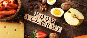 Food Allergies: Things You Must Know in Charleston, SC